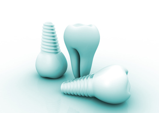 Why Can’t Children Get Dental Implants